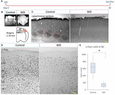 Permanent Whisker Removal Reduces the Density of c-Fos+ Cells and the Expression of Calbindin Protein, Disrupts Hippocampal Neurogenesis and Affects Spatial-Memory-Related Tasks